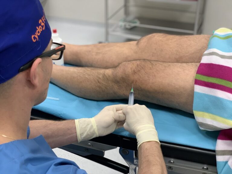 injekcja dostawowa komórek mezenchymalnych